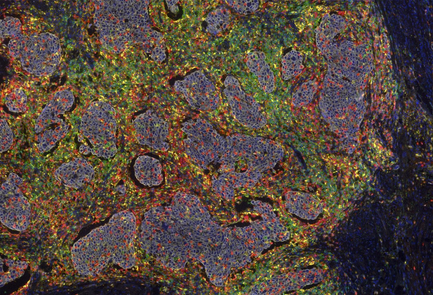 NKI Website Mvdheijden