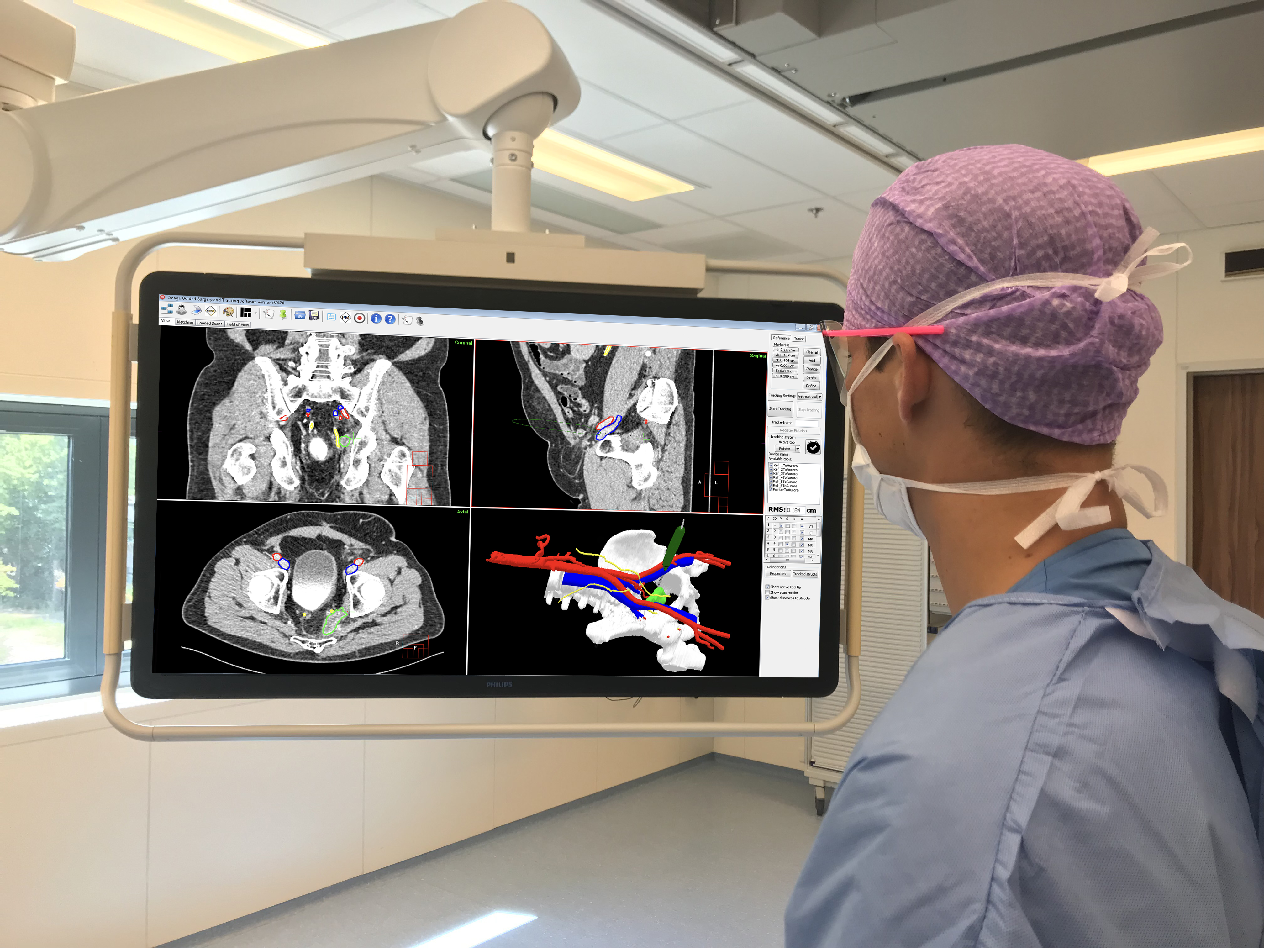 Surgical Naviagtion